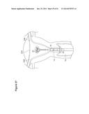 UTERINE LAVAGE FOR EMBRYO RETRIEVAL diagram and image