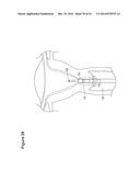 UTERINE LAVAGE FOR EMBRYO RETRIEVAL diagram and image