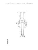 UTERINE LAVAGE FOR EMBRYO RETRIEVAL diagram and image