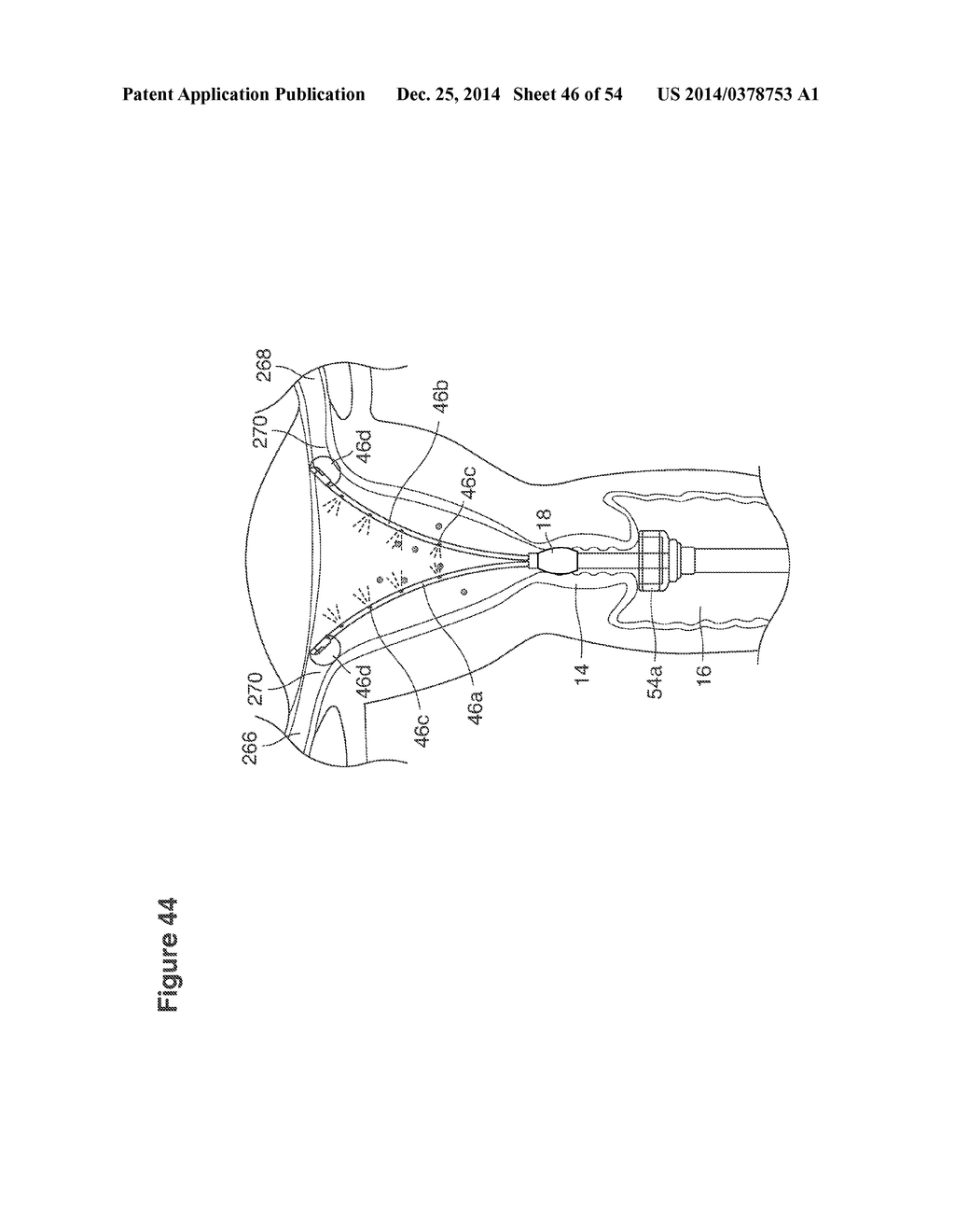 UTERINE LAVAGE FOR EMBRYO RETRIEVAL - diagram, schematic, and image 47