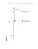 UTERINE LAVAGE FOR EMBRYO RETRIEVAL diagram and image