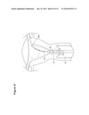 UTERINE LAVAGE FOR EMBRYO RETRIEVAL diagram and image