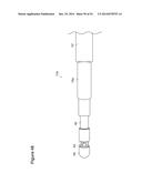 UTERINE LAVAGE FOR EMBRYO RETRIEVAL diagram and image