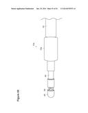 UTERINE LAVAGE FOR EMBRYO RETRIEVAL diagram and image