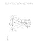 UTERINE LAVAGE FOR EMBRYO RETRIEVAL diagram and image