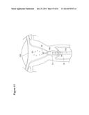 UTERINE LAVAGE FOR EMBRYO RETRIEVAL diagram and image