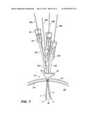 Unitary multilumen cranial bolt diagram and image