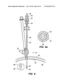 Unitary multilumen cranial bolt diagram and image