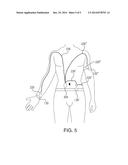 REMOTELY POWERED SENSOR WITH ANTENNA LOCATION INDEPENDENT OF SENSING SITE diagram and image