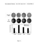 METHOD OF DIAGNOSIS AND TREATMENT OF TUMORS USING HIGH INTENSITY FOCUSED     ULTRASOUND diagram and image