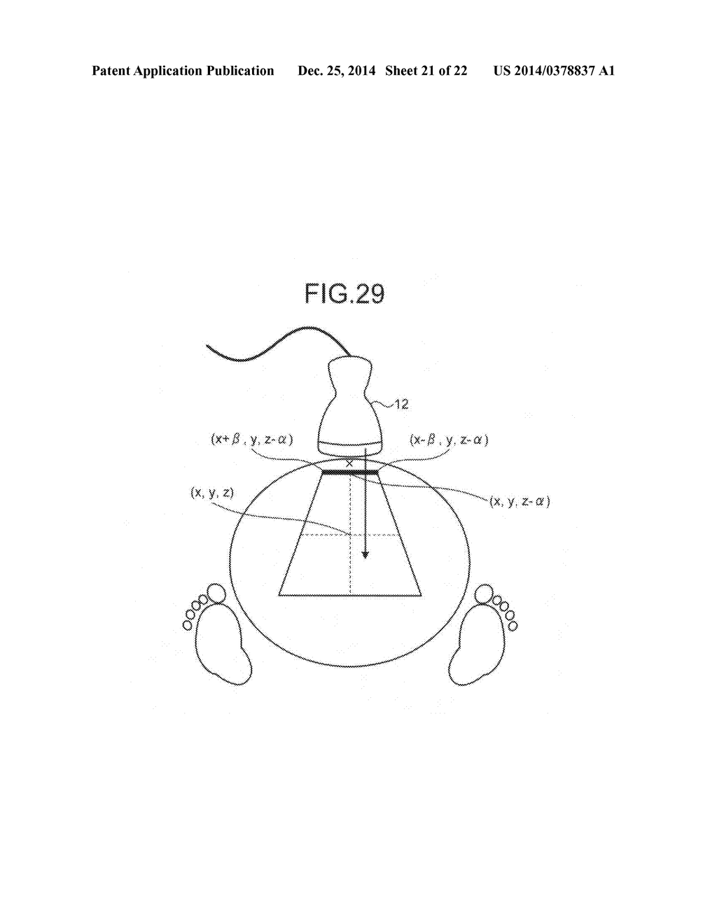 ULTRASOUND DIAGNOSTIC APPARATUS - diagram, schematic, and image 22