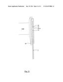 Lower Leg Orthosis diagram and image