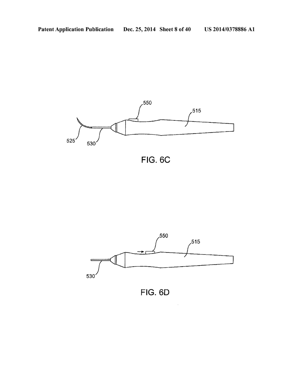 Glaucoma Treatment Device - diagram, schematic, and image 09