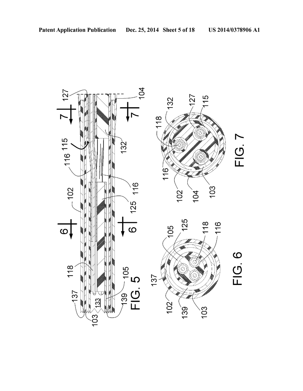 PERI-VASCULAR TISSUE ABLATION CATHETER WITH MECHANICAL SUPPORT STRUCTURES - diagram, schematic, and image 06