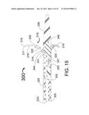 PERI-VASCULAR TISSUE ABLATION CATHETER WITH MECHANICAL SUPPORT STRUCTURES diagram and image