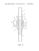 Nasogastric Tube diagram and image