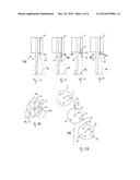 SURGICAL INSTRUMENT WITH TISSUE RECOGNITION diagram and image