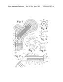 BONE FIXATION DEVICE diagram and image