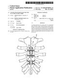 LOCKING MECHANISM TO SECURE ENDS OF AN IMPLANTABLE FABRIC diagram and image