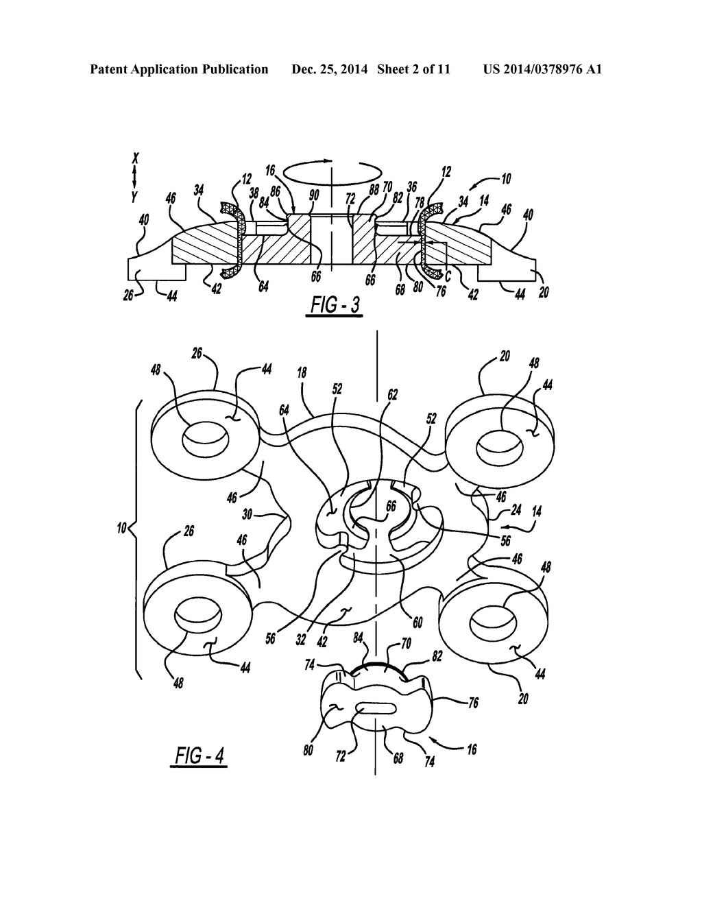 LOCKING MECHANISM TO SECURE ENDS OF AN IMPLANTABLE FABRIC - diagram, schematic, and image 03