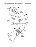 LOCKING MECHANISM TO SECURE ENDS OF AN IMPLANTABLE FABRIC diagram and image