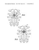 LOCKING MECHANISM TO SECURE ENDS OF AN IMPLANTABLE FABRIC diagram and image