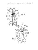 LOCKING MECHANISM TO SECURE ENDS OF AN IMPLANTABLE FABRIC diagram and image