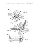 LOCKING MECHANISM TO SECURE ENDS OF AN IMPLANTABLE FABRIC diagram and image