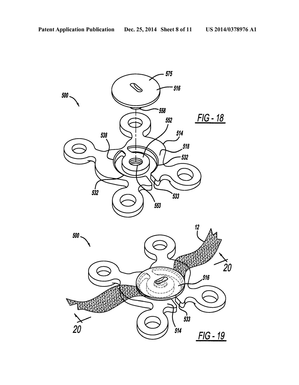 LOCKING MECHANISM TO SECURE ENDS OF AN IMPLANTABLE FABRIC - diagram, schematic, and image 09