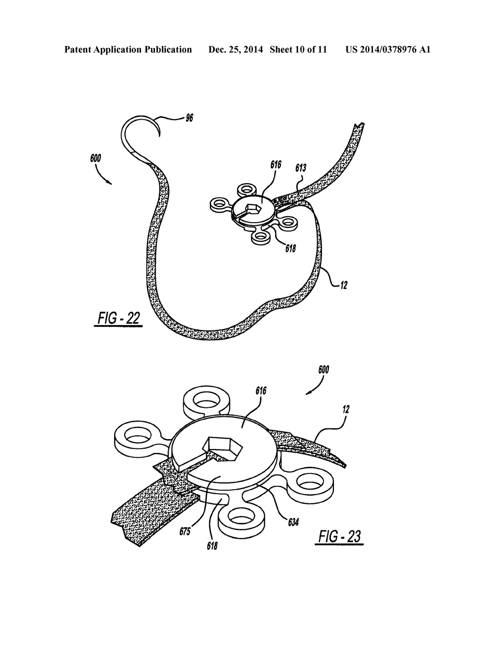 LOCKING MECHANISM TO SECURE ENDS OF AN IMPLANTABLE FABRIC - diagram, schematic, and image 11