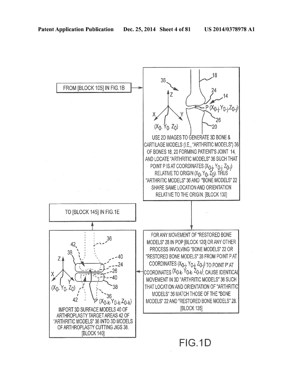 ARTHROPLASTY JIGS WITH MATING ACCURACY - diagram, schematic, and image 05