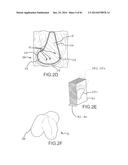 ARTHROPLASTY JIGS WITH MATING ACCURACY diagram and image