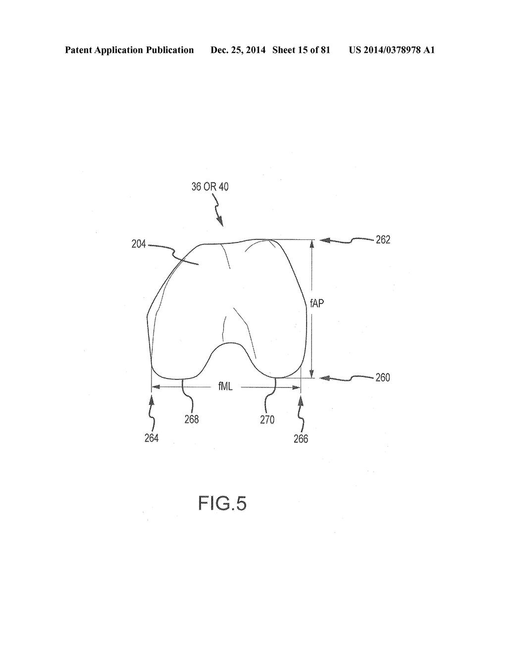 ARTHROPLASTY JIGS WITH MATING ACCURACY - diagram, schematic, and image 16