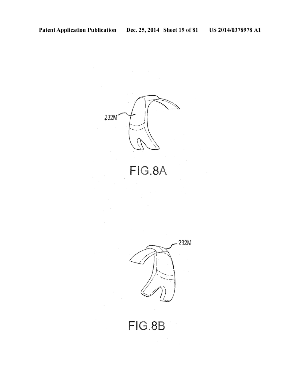 ARTHROPLASTY JIGS WITH MATING ACCURACY - diagram, schematic, and image 20