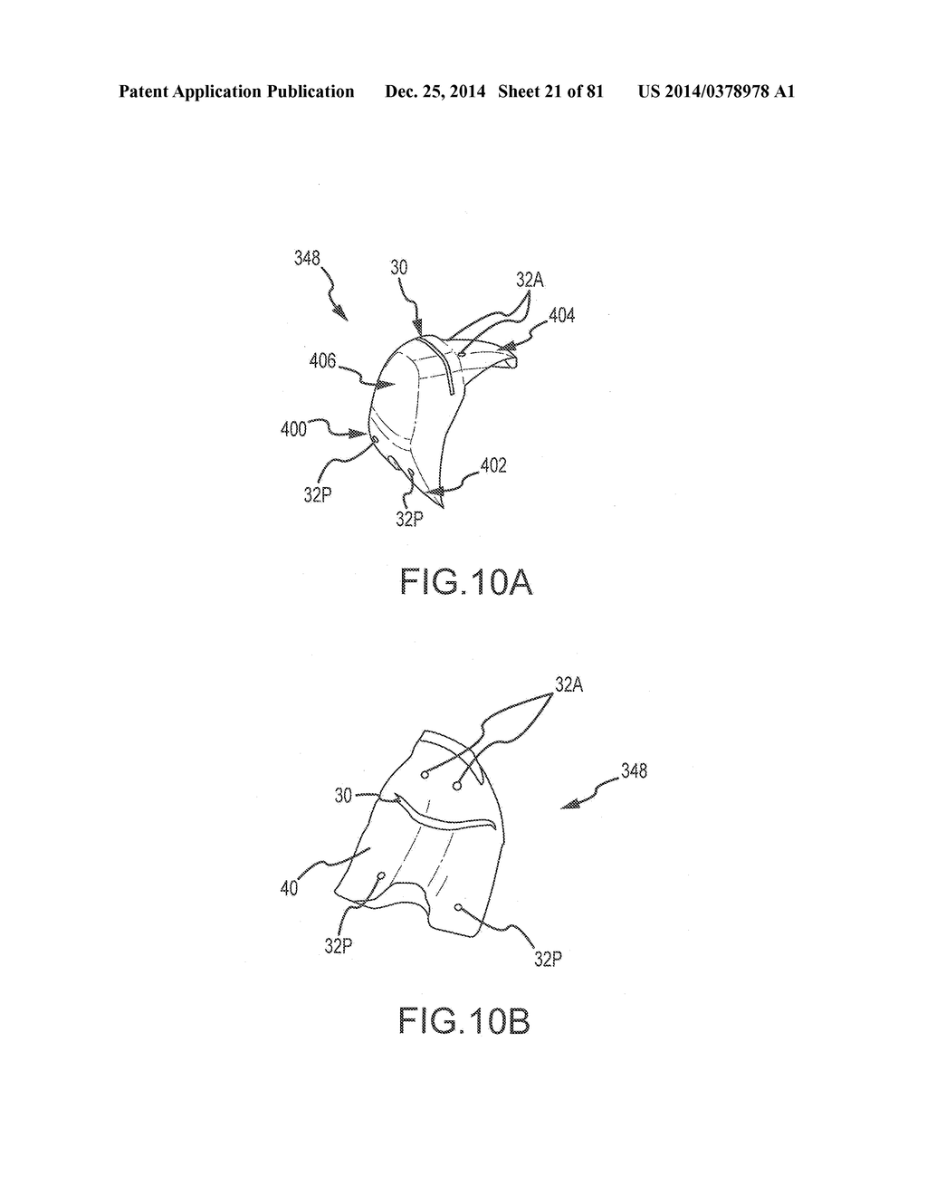 ARTHROPLASTY JIGS WITH MATING ACCURACY - diagram, schematic, and image 22