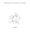 ARTHROPLASTY JIGS WITH MATING ACCURACY diagram and image