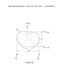 ARTHROPLASTY JIGS WITH MATING ACCURACY diagram and image