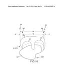 ARTHROPLASTY JIGS WITH MATING ACCURACY diagram and image