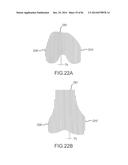 ARTHROPLASTY JIGS WITH MATING ACCURACY diagram and image