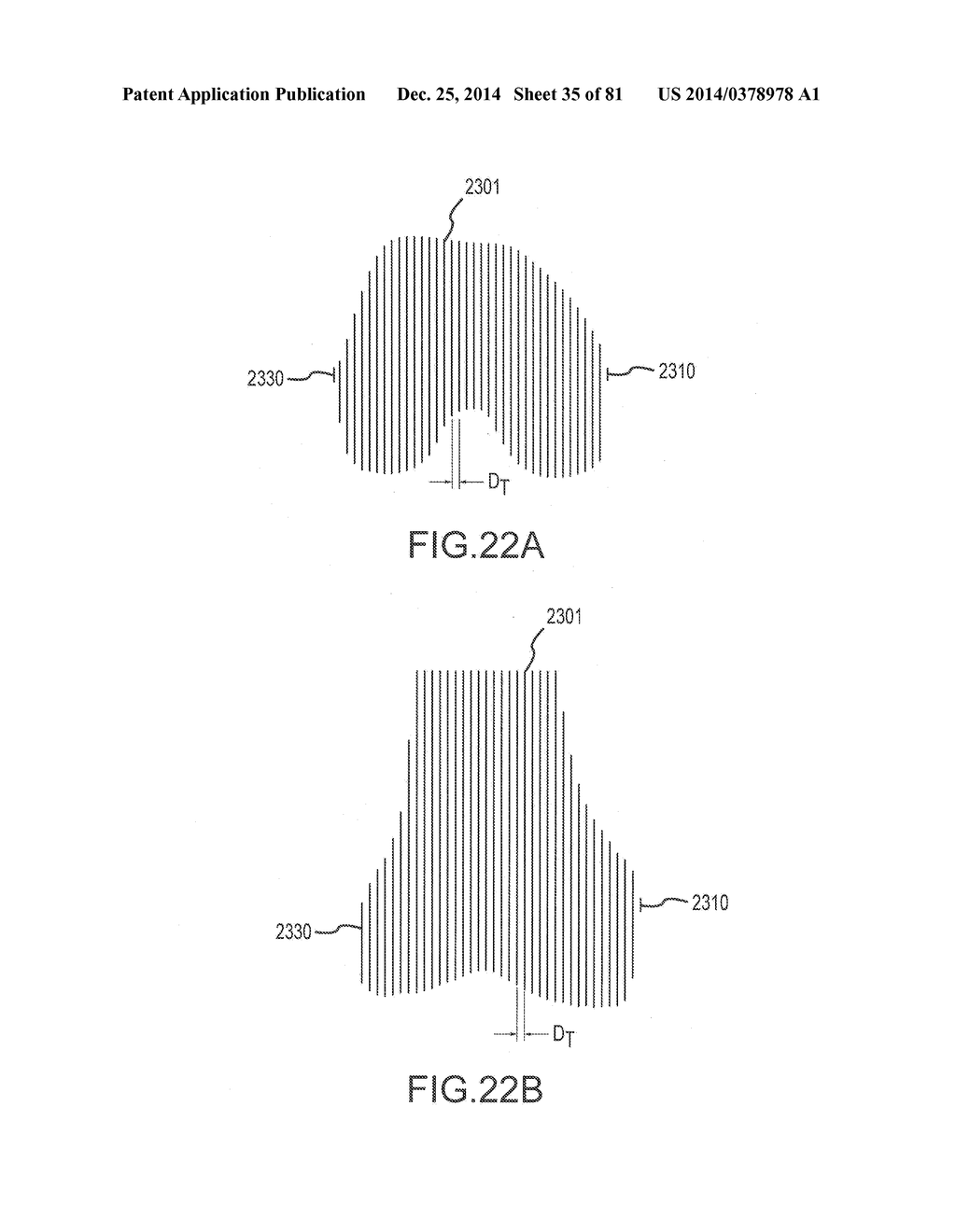 ARTHROPLASTY JIGS WITH MATING ACCURACY - diagram, schematic, and image 36