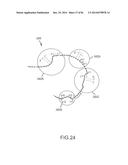 ARTHROPLASTY JIGS WITH MATING ACCURACY diagram and image