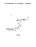 ARTHROPLASTY JIGS WITH MATING ACCURACY diagram and image