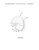 ARTHROPLASTY JIGS WITH MATING ACCURACY diagram and image