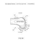 ARTHROPLASTY JIGS WITH MATING ACCURACY diagram and image