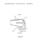 ARTHROPLASTY JIGS WITH MATING ACCURACY diagram and image