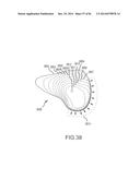 ARTHROPLASTY JIGS WITH MATING ACCURACY diagram and image