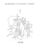 ARTHROPLASTY JIGS WITH MATING ACCURACY diagram and image