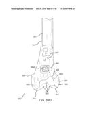 ARTHROPLASTY JIGS WITH MATING ACCURACY diagram and image