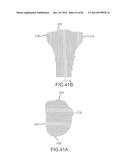 ARTHROPLASTY JIGS WITH MATING ACCURACY diagram and image