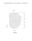 ARTHROPLASTY JIGS WITH MATING ACCURACY diagram and image